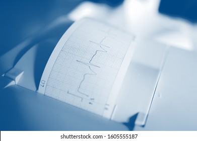 Printing Of Cardiogram Report Coming Out From Electrocardiograph In Labour Ward