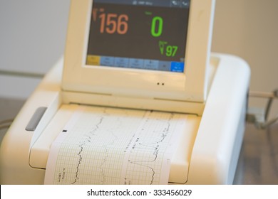 Printing Of Cardiogram Report Coming Out From Electrocardiograph In Labour Ward