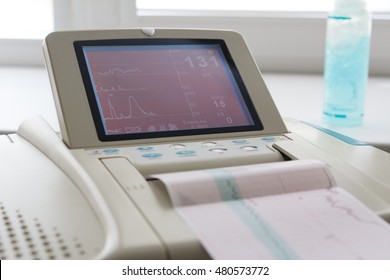 Printing Of Cardiogram Report Coming Out From Electrocardiograph In Labour Ward