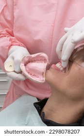 Printing is the process of making the upper and lower jaw molds using dental molding materials (alginate).