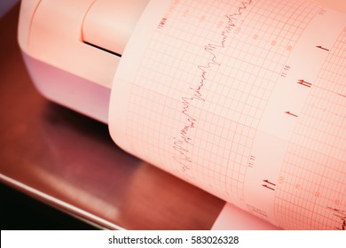 Printing Richter Scale Of Cardiogram Beat Report Coming Out From Electrocardiograph In The Hospital With Copy Space. Fetal Medical Care Concept