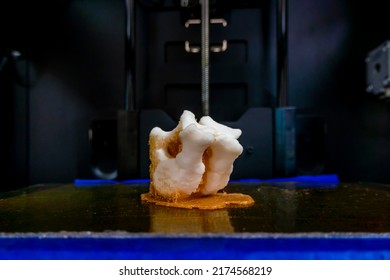 Printing Vertebrae On A 3d Printer. Artificial Body Parts Printed On A 3d Printer. New Era Of Medicine. Printing On A 3d Printer. Orange Trident Is Printed With Plastic On A 3d Printer