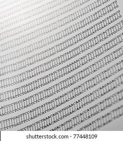 Printout Of A Gene DNA Sequence Alignment