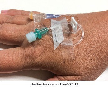 Pripheral Intravenous Catheter Or Iv Cannula To Be Ready To Inject Or Administer Blood Vessels