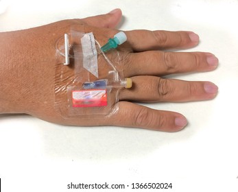 Pripheral Intravenous Catheter Or Iv Cannula To Be Ready To Inject Or Administer Blood Vessels