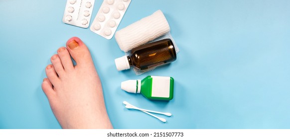 Problem of injured toenail, treatment in clinic. Diagnosis, treatment of mycosis of feet. Podiatrist treating ingrown toenail. Inflammation of the toes. doctor disinfect the injured toenail. medicines - Shutterstock ID 2151507773