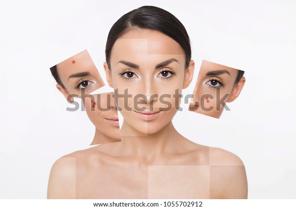 Problem skin of face. Part of\
face. Beauty woman collage. Portrait of a beautiful young smiling\
woman with fresh and clean skin. Skin care. Cosmetology. Women\
Health
