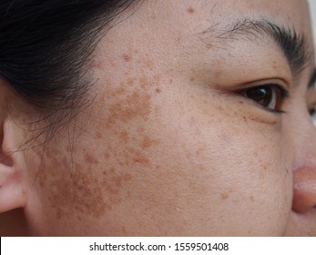 Brown Spots Images Stock Photos Vectors Shutterstock