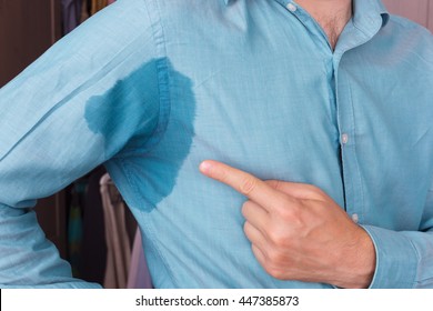 problem with sweating - hyperhidrosis