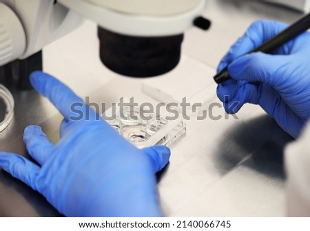 process of artificial insemination of an egg in an IVF clinic.