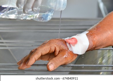 Process Cleaning Wound By Normal Saline At First.