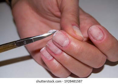 The Process Of Cutting Nails On A Woman's Thumb. Nail Clipping