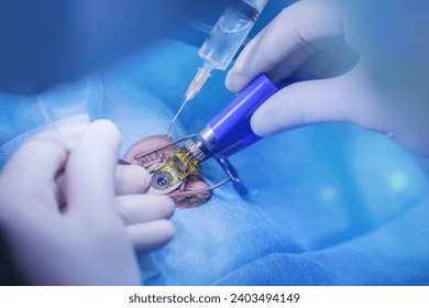 Process laser vision correction, lasik treatment. Doctor use equipment for corneal flap formation. 