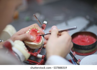 The Process Of Making A Dental Prosthesis In A Dental Laboratory
