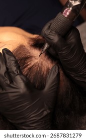 Process of scalp micropigmentation (SMP) – creating the appearance of natural hair follicles on the scalp using precise micro tattooing technique.