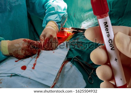 Process surgery operation of holding test tube with blood MERS-CoV Novel Corona virus concept with operating room