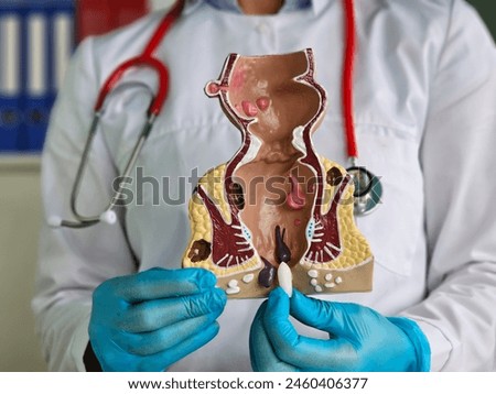 Proctologist doctor inserting rectal suppository into artificial model of human rectum