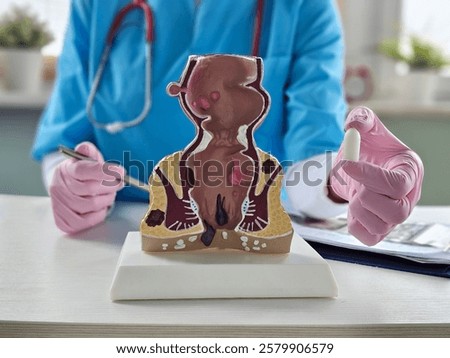 Proctologist doctor inserting rectal suppository into artificial model of human rectum closeup