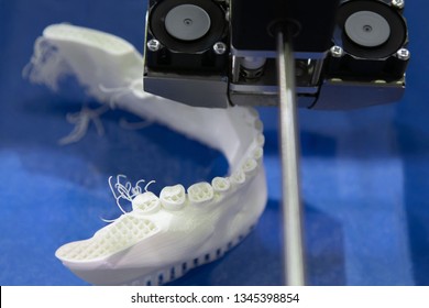 Production Of Dental Prostheses. Printing On A 3D Printer