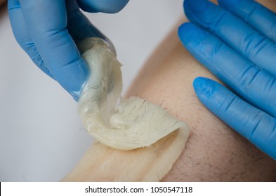 professional hands of the salon employee in latex blue gloves cause a paste of sugar for depilation on the female slender hairy legs of the client