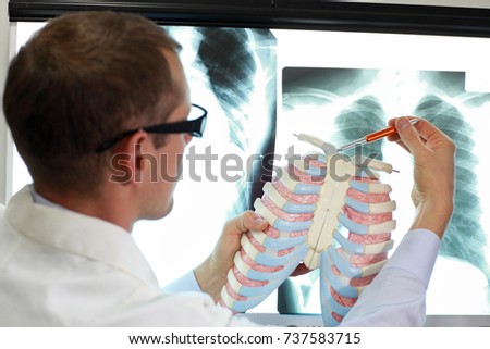 professional with ribs and lungs model watching image of chest at x-ray film viewer