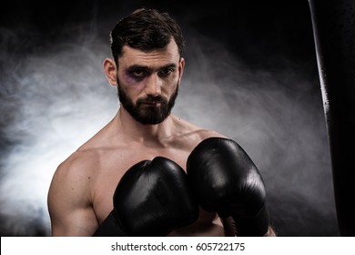 Professional Young Boxer With Black Eye Looking At Camera Isolated On Black