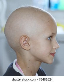 Profile Of A Caucasian Child Showing Hair Loss Due To Chemotherapy Treatment For Cancer