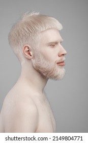 Profile portrait of young bearded albino man with naked shoulders, turning head aside while posing over grey studio background. Albinism, skin abnormality