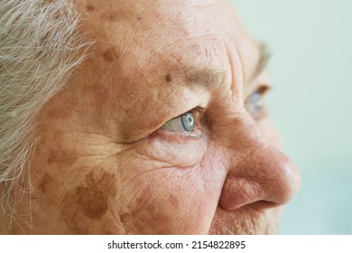 Profile View Of The Face Of A Gray-haired Elderly Woman, 80 Years Old, With Wrinkles, Age Spots On The Skin