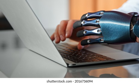 Programmer Man Hands With Artificial Bio Prothesis Type On Laptop Keyboard On Table Under Bright Sunlight In Office Extreme Closeup