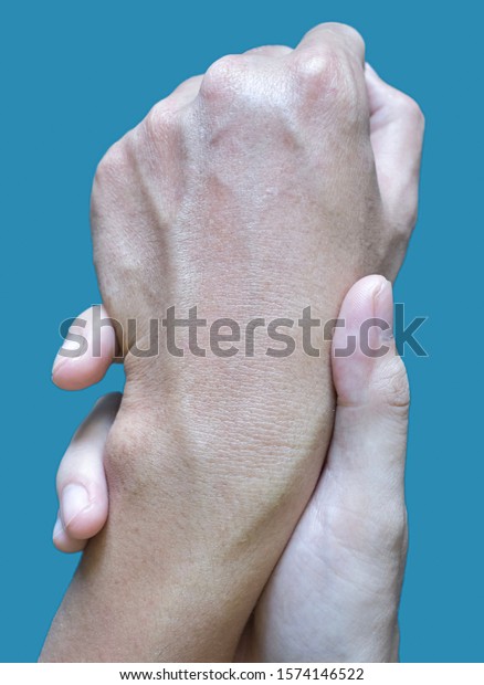 Prominent Dorsal Metacarpal Veins Left Hand Stock Photo Edit Now 1574146522