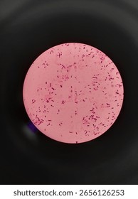 propiomibacterium acnes in 1000x microscope