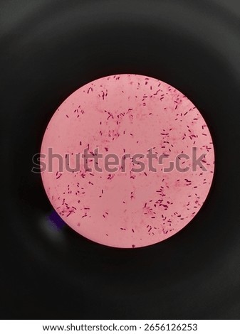propiomibacterium acnes in 1000x microscope