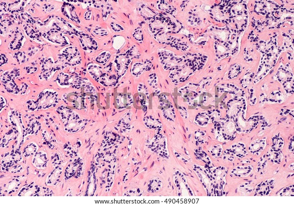 histología de la glándula prostática