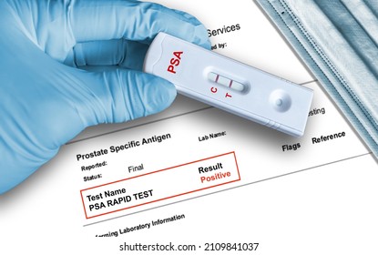 Prostate Specific Antigen PSA positive test result by using rapid testing device held by hand in medical glove with medical face mask in background. PSA is a tumor marker that detects prostate cancer