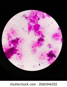 Gram Negative Diplococci Images Stock Photos Vectors Shutterstock