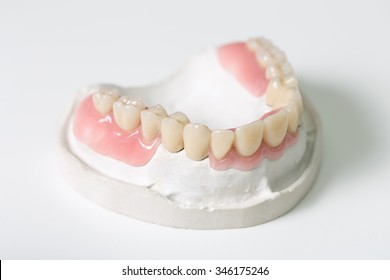 Removable Partial Denture Metal Plastic Dental Stock Photo (Edit Now ...