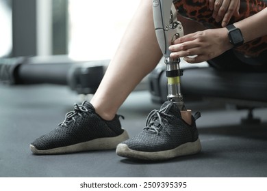 prosthetic, artificial leg. Woman with prosthetic leg using walking on treadmill while working out in gym. artificial leg. Woman wearing prosthetic equipment sit down after exercising in gym.	
 - Powered by Shutterstock