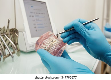  Prothetik Hände während der Arbeit an den Prothesen, falsche Zähne, eine Studie und einen Tisch mit zahnärztlichen Werkzeugen. Zahnlabor.