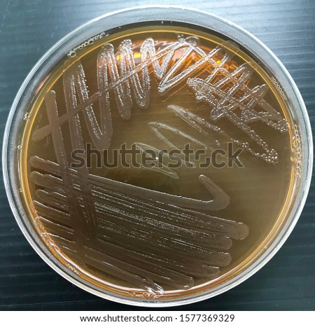 Proteus mirabilis  on macconkey agar