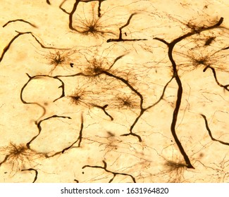 Protoplasmic astrocytes impregnated with the Golgi method. They are located in the grey matter and have numerous processes, almost all of the same length. The thick black strokes are blood vessels