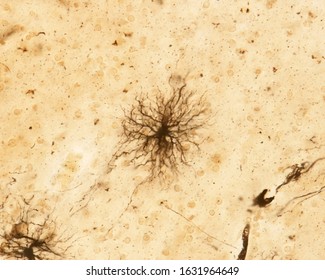 Protoplasmic astrocytes impregnated with the silver chromate Golgi method. They are located in the grey matter and have numerous processes, almost all of the same length.