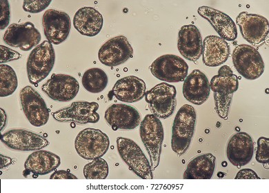 Echinococcosis Images Stock Photos Vectors Shutterstock