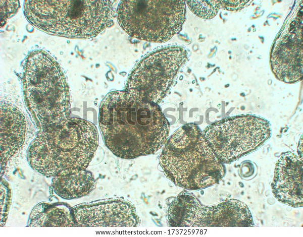 Protoscolices Echinococcus Multilocularis Microscopic Photo Being Stock Photo Edit Now 1737259787