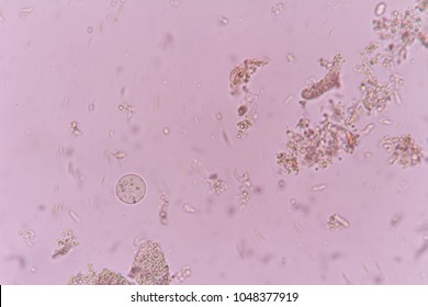 Protozoa entamoeba coli in stool. Stock Photo