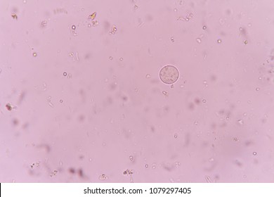 Protozoa entamoeba coli in stool. Stock Photo