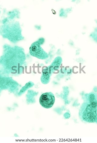 Protozoa Entamoeba histolytica Trophozoite stage in stool examination  Foto stock © 