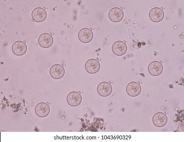 Protozoa in stool entamoeba coli. Stock Photo