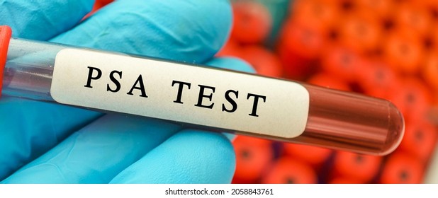 PSA test result with blood sample in test tube in hand