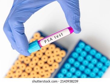 PSA test result with blood sample tube